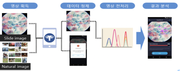 ▲ 두에이아이의 자궁경부암 조기진단을 위한 인공지능 솔루션 개발 과정. (사진제공=두에이아이)