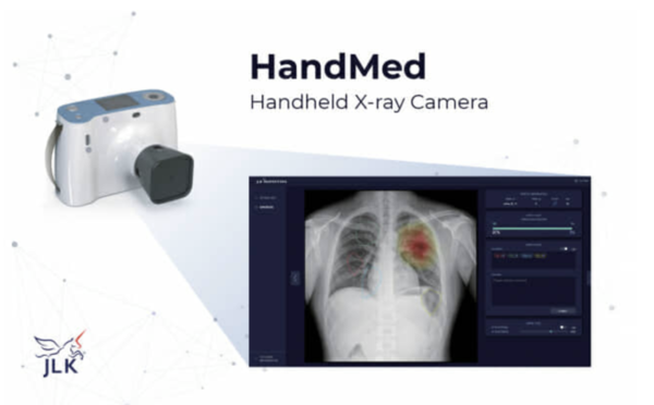 ▲ 핸드메드-제이뷰어엑스(왼쪽)와 X레이 장면.