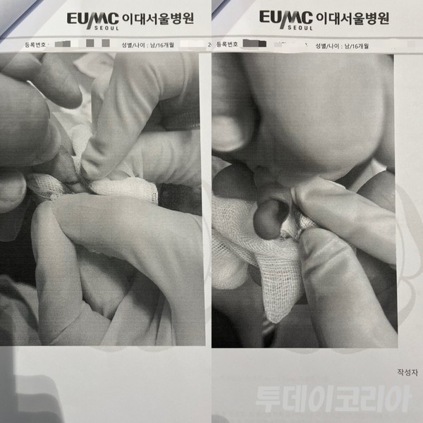 이대서울병원 외과에서 성형외과로 보낸 타과 의뢰서.  사진=제보자